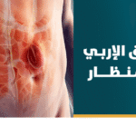 علاج الفتق الإربي بالمنظار