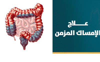 علاج الإمساك المزمن