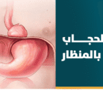 علاج فتق الحجاب الحاجز بالمنظار