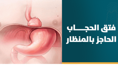 علاج فتق الحجاب الحاجز بالمنظار