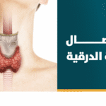 استئصال الغدة الدرقية