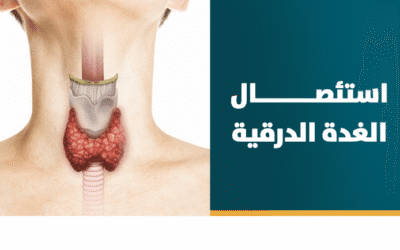 استئصال الغدة الدرقية